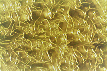 Steinernema feltiae unter dem Mikroskop